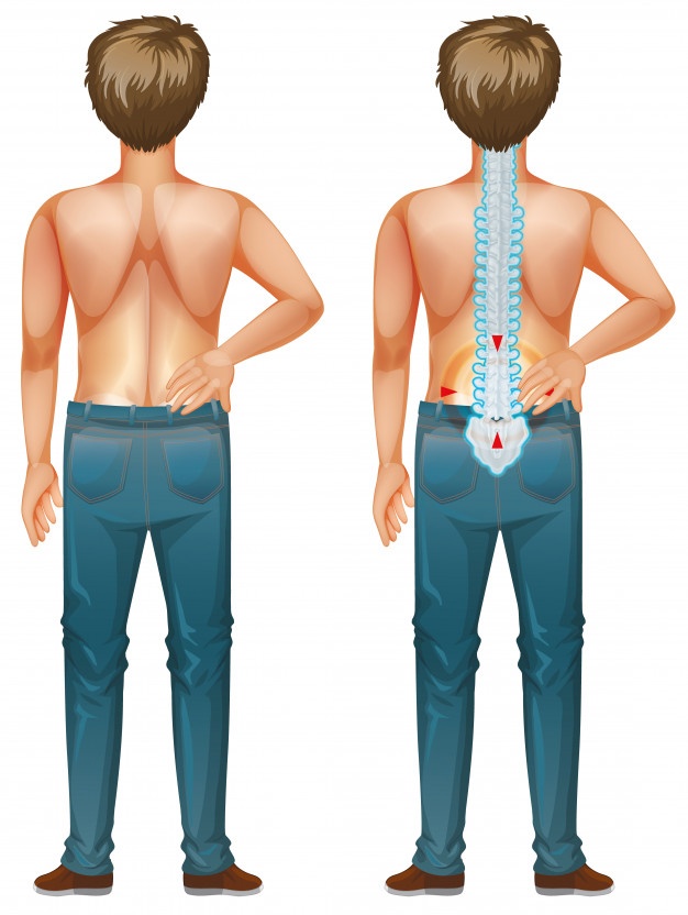 Tratamiento y recomendaciones para el lumbago