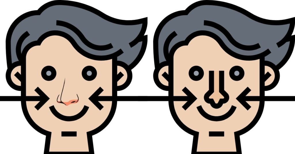 Rinoplastia y cuidados